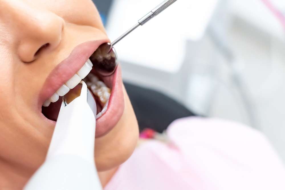 Top Benefits of Dental Checkups for a Healthy Smile and Overall Wellness