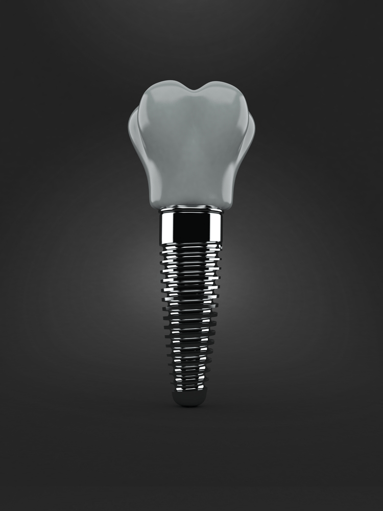 odsp dental implants